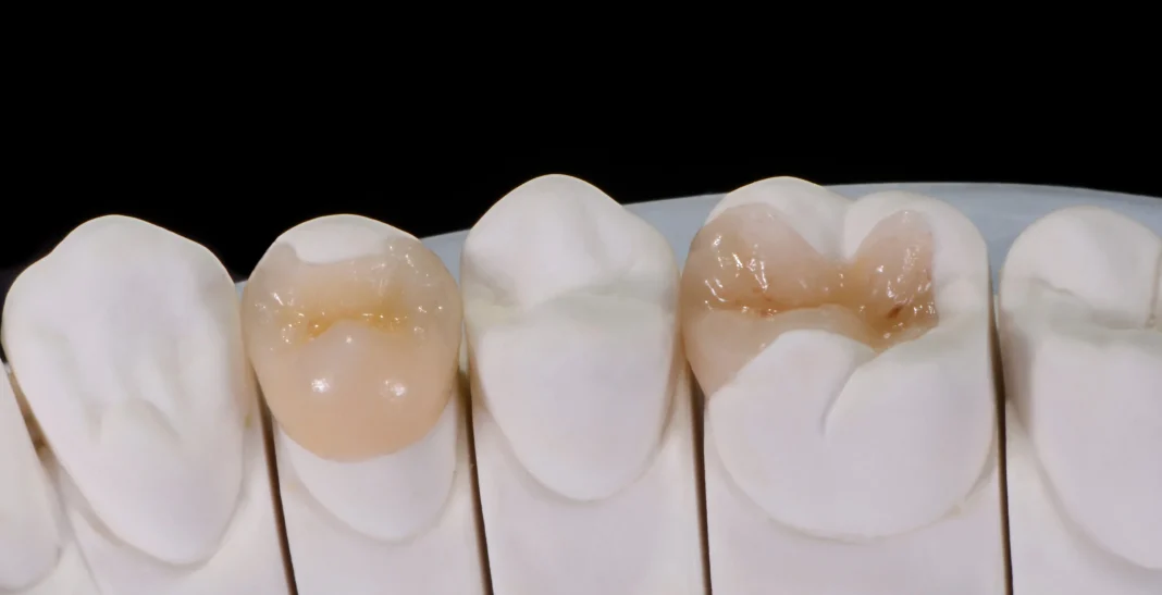 Modern Approaches to Restoring Dental Function and Aesthetics